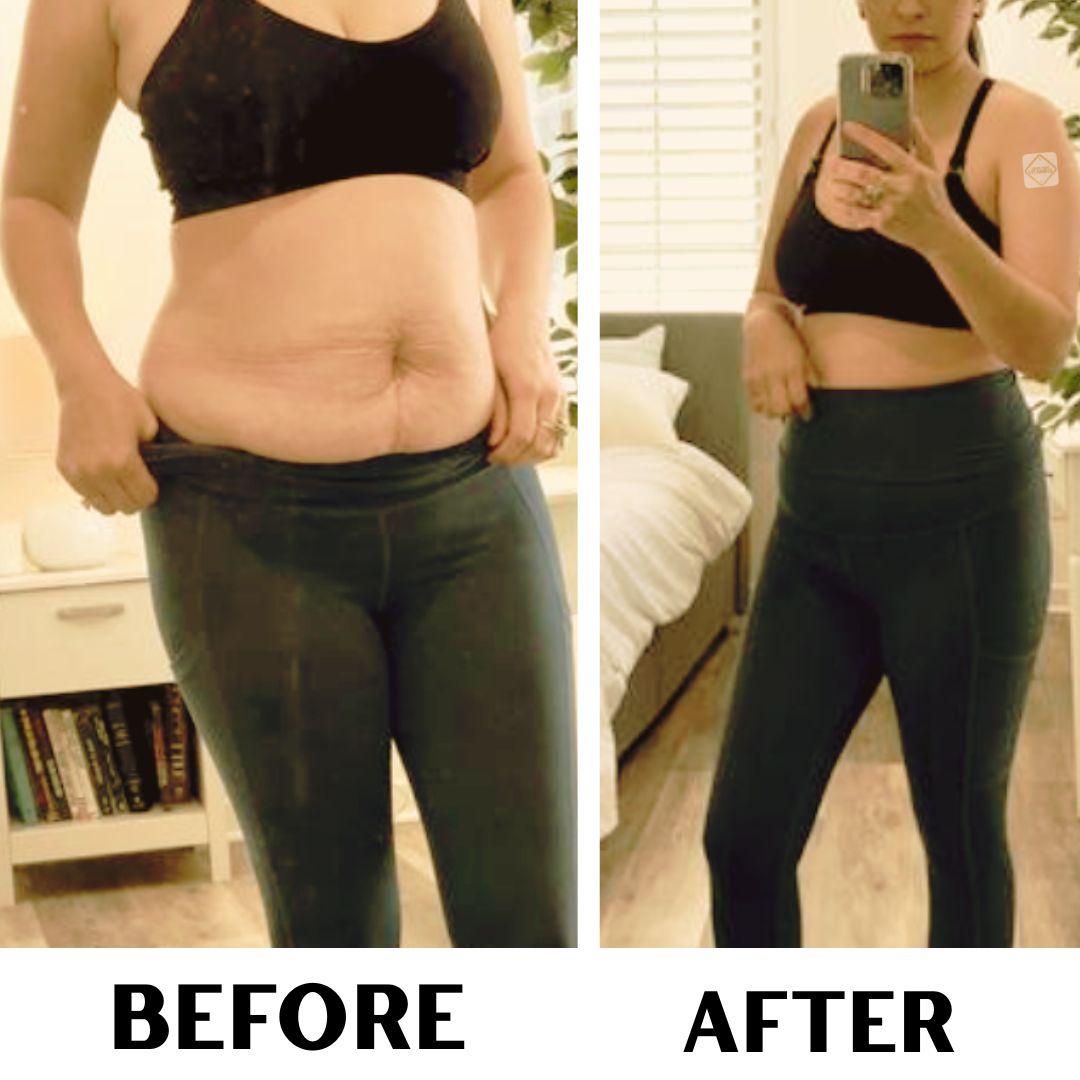 TrimPure Gold Patch Women's Health review image from Supplement Skeptic