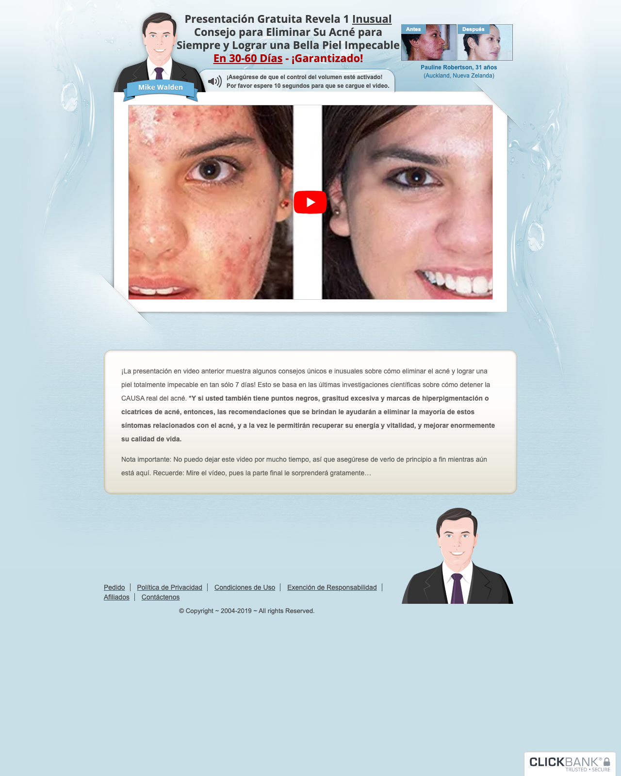 Screenshot of the Acné No Más(TM)~ Spanish Acne No More(TM)~ New Video Sales Letter! sales page — open current offer