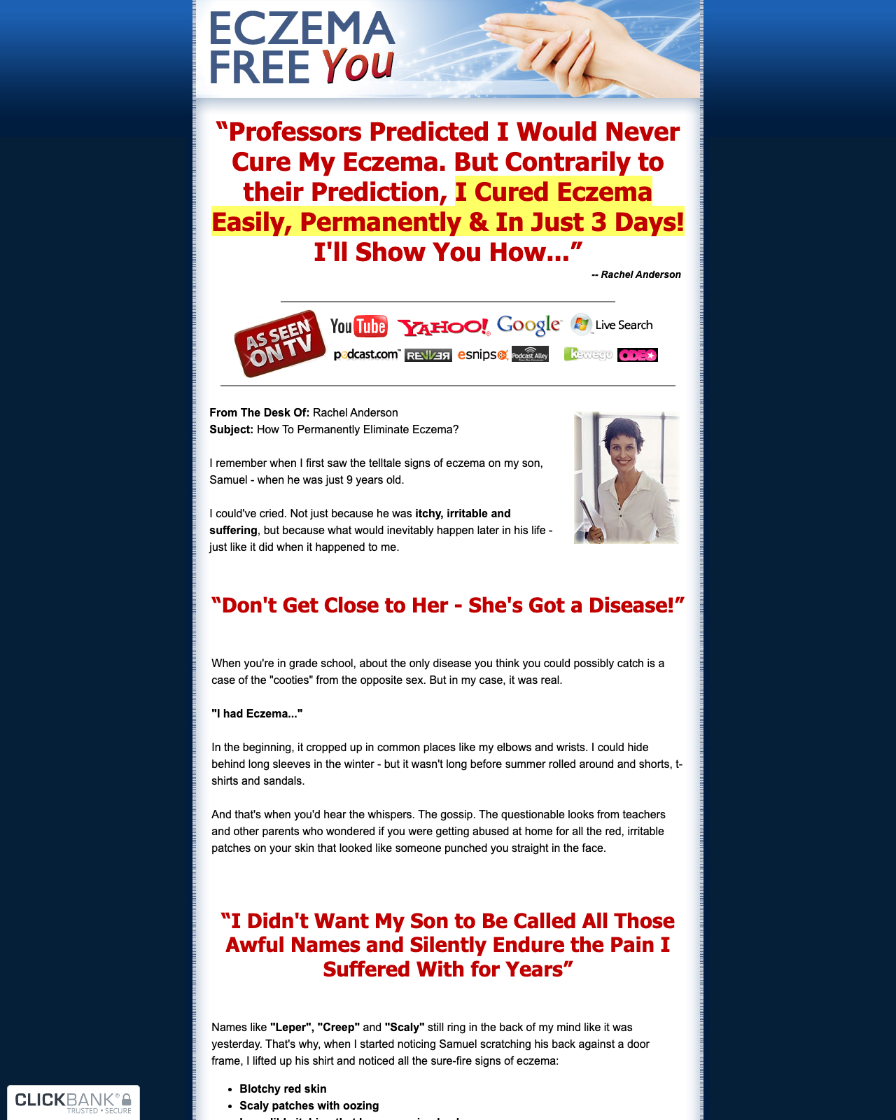 Screenshot of the Eczema Free You - Updated for 2020! sales page — open current offer