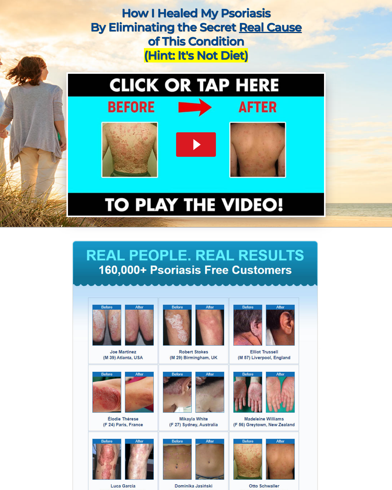 Screenshot of the Psoriasis Revolution (TM)~  New Conversion Monster On CB sales page — open current offer