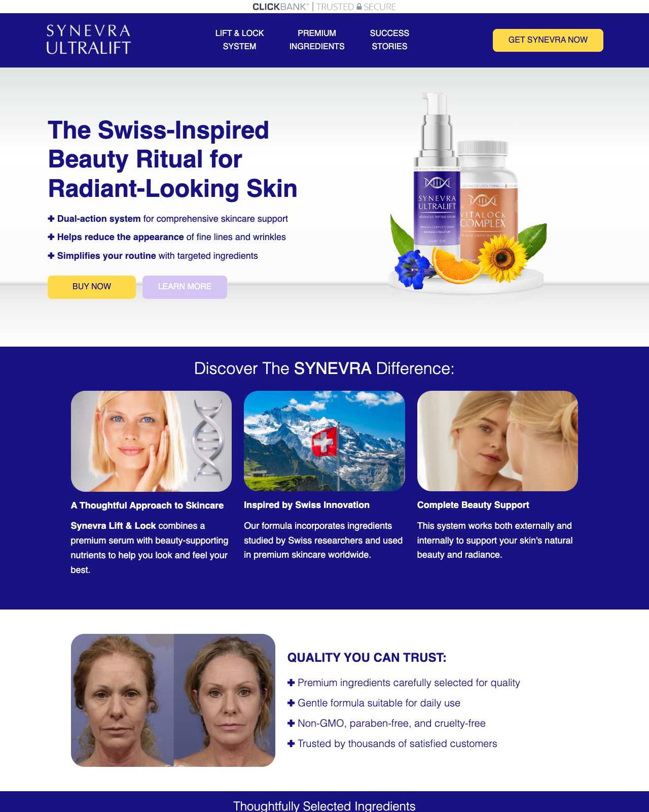 Screenshot of the Synevra UltraLift - New Snake Venom Skin Serum Offer sales page — open current offer